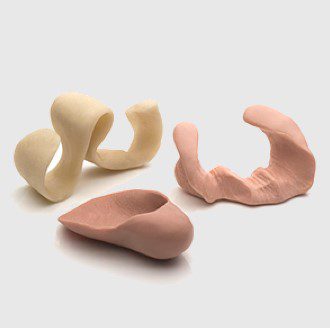 diabetische voet fig02