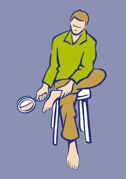 diabetische voet fig09