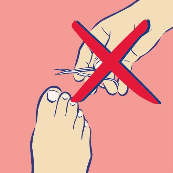 diabetische voet fig15