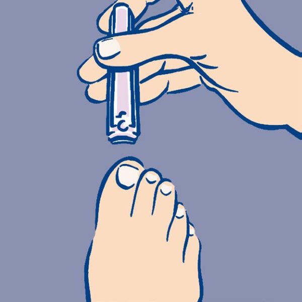 diabetische voet fig16