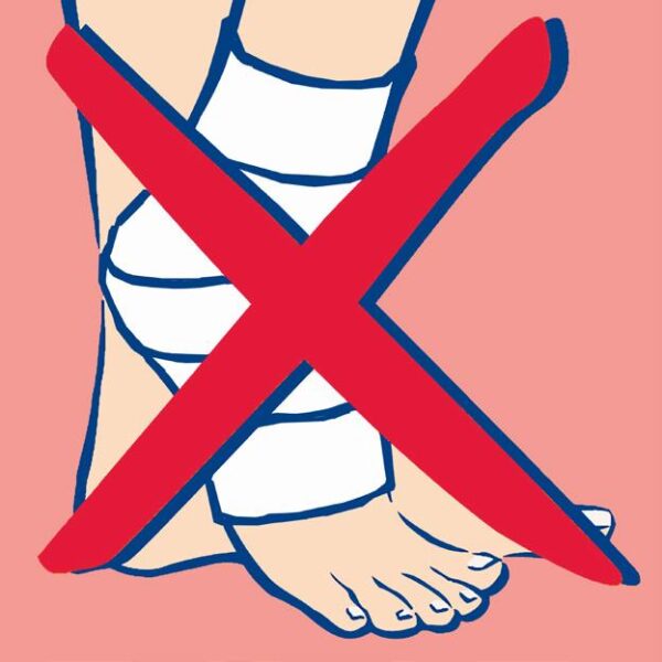 diabetische voet fig22