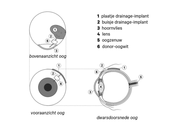 doorsnede_oog_2.jpeg