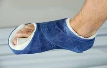 hallux valgus fig3 gipsschoen