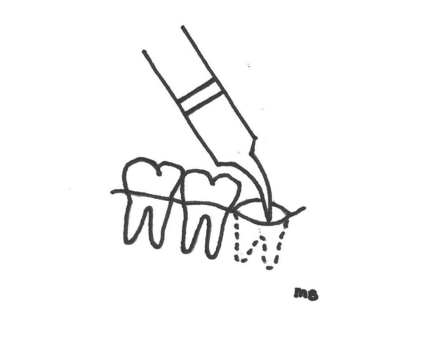 monoject spuitje in mond