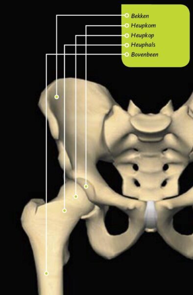 totale heupprothese fig1