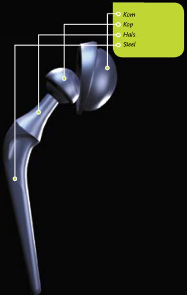 totale heupprothese fig 3